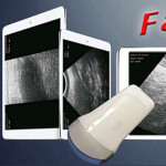 Sonda ecografica wireless